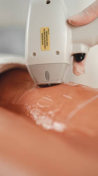 Epilation laser remboursement