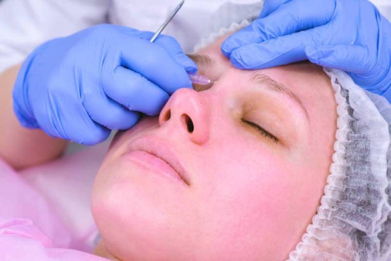 Rhinoplastie PACA