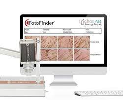 Diagnostiquez avec précision vos problèmes capillaires à Aix-en-Provence grâce à la trichoscopie numérique Tricholab chez Inkoff