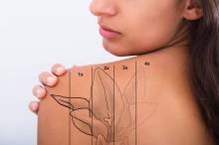 Notre zone d'activité pour ce service Détatouage picolaser unique en France à